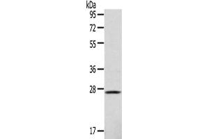Gel: 10 % SDS-PAGE,Lysate: 40 μg,Primary antibody: ABIN7128967(CLEC4D Antibody) at dilution 1/123 dilution,Secondary antibody: Goat anti rabbit IgG at 1/8000 dilution,Exposure time: 1 minute (CLEC4D antibody)