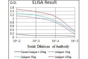 Black line: Control Antigen (100 ng), Purple line: Antigen(10 ng), Blue line: Antigen (50 ng), Red line: Antigen (100 ng), (TWIST1 antibody  (AA 9-74))