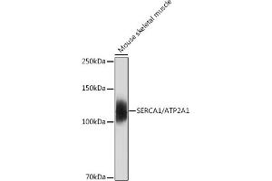 Western blot analysis of extracts of Mouse skeletal muscle, using SERC/ Rabbit mAb (9639) at 1:500 dilution. (ATP2A1/SERCA1 antibody)