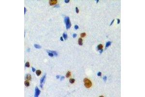 Immunohistochemical analysis of MKI67IP (pT234) staining in human brain formalin fixed paraffin embedded tissue section. (NIFK antibody  (pSer234))