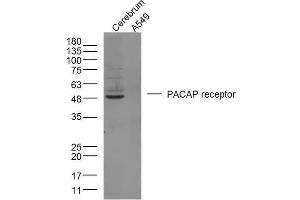 Western Blotting (WB) image for anti-Adenylate Cyclase Activating Polypeptide 1 (Pituitary) Receptor Type I (ADCYAP1R1) (AA 251-330) antibody (ABIN726185)