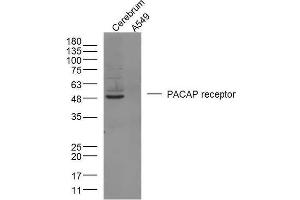 Mouse brain lysates and Human A549 cells probed with PACAP receptor 1 Polyclonal Antibody, unconjugated  at 1:300 overnight at 4°C followed by a conjugated secondary antibody at 1:10000 for 90 minutes at 37°C. (ADCYAP1R1 antibody  (AA 251-330))