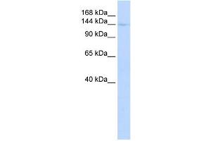 WB Suggested Anti-CIITA Antibody Titration:  0. (CIITA antibody  (Middle Region))