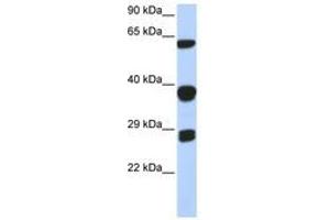 Image no. 1 for anti-Small Nuclear Ribonucleoprotein Polypeptides B and B1 (SNRPB) (AA 72-121) antibody (ABIN6740670) (SNRPB antibody  (AA 72-121))