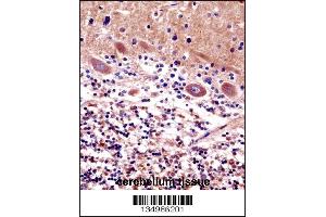 CDR2 Antibody immunohistochemistry analysis in formalin fixed and paraffin embedded human cerebellum tissue followed by peroxidase conjugation of the secondary antibody and DAB staining. (CDR2 antibody  (C-Term))