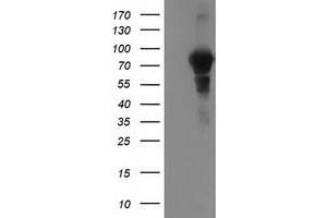 HEK293T cells were transfected with the pCMV6-ENTRY control (Left lane) or pCMV6-ENTRY VCAM1 (Right lane) cDNA for 48 hrs and lysed. (VCAM1 antibody)