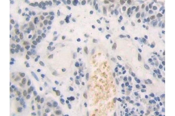 HMGN2 antibody  (AA 2-81)