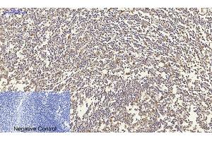 Immunohistochemical analysis of paraffin-embedded human tonsil tissue. (N-Cadherin antibody  (AA 690-770))