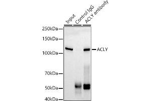 Immunoprecipitation analysis of 300 μg extracts of HepG2 cells using 3 μg ACLY antibody (ABIN1678575, ABIN7101559, ABIN7101560 and ABIN7101561). (ACLY antibody)