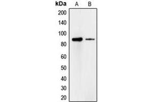 Western blot analysis of Cadherin 18 expression in A549 (A), HeLa (B) whole cell lysates. (CDH18 antibody  (Center))