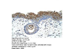 Rabbit Anti-EIF2A Antibody  Paraffin Embedded Tissue: Human Skin Cellular Data: Epidermal cells Antibody Concentration: 4. (EIF2A antibody  (C-Term))