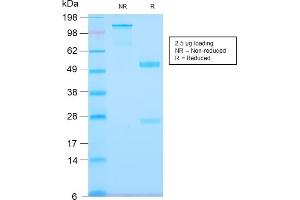 SDS-PAGE Analysis Purified Tenascin C Rabbit Recombinant Monoclonal Antibody (TNC/2981R). (Recombinant TNC antibody)