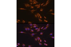 Immunofluorescence analysis of C6 cells using CNTF Rabbit pAb (ABIN3015704, ABIN3015705, ABIN3015706 and ABIN6219054) at dilution of 1:100 (40x lens).