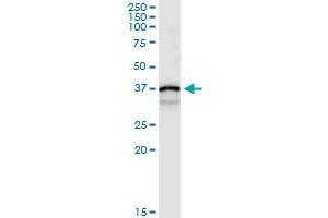 Immunoprecipitation of CTSS transfected lysate using rabbit polyclonal anti-CTSS and Protein A Magnetic Bead