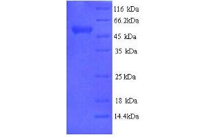SDS-PAGE (SDS) image for Arylsulfatase B (ARSB) (AA 37-533) protein (His tag) (ABIN5713258)