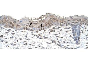 Immunohistochemistry (IHC) image for anti-Arrestin, beta 2 (ARRB2) (Middle Region) antibody (ABIN2783190)