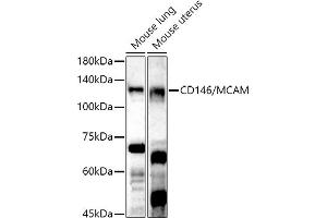 Western Blotting (WB) image for anti-Melanoma Cell Adhesion Molecule (MCAM) (AA 447-646) antibody (ABIN6143621)