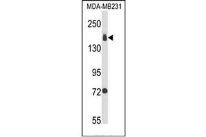 Western blot analysis of CD49b / ITGA2 Antibody (C-term) in MDA-MB231 cell line lysates (35ug/lane). (ITGA2 antibody  (C-Term))