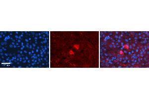 Immunohistochemistry (IHC) image for anti-Nuclear Factor-kB p65 (NFkBP65) (Middle Region) antibody (ABIN2779331)