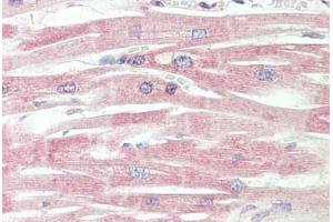 Human, Heart: Formalin-Fixed Paraffin-Embedded (FFPE) (ICA1 antibody  (AA 74-123))