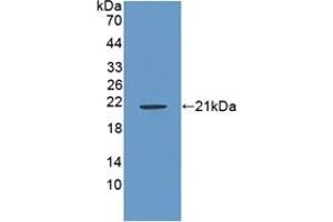 Detection of Recombinant RSPO1, Rat using Polyclonal Antibody to R-Spondin 1 (RSPO1) (RSPO1 antibody  (AA 136-262))