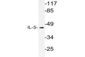 Western blot (WB) analysis of IL-5 antibody in extracts from HT-29 cells.