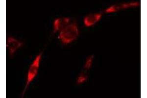 ABIN6275436 staining Hela cells by IF/ICC. (RAB3GAP2 antibody  (Internal Region))