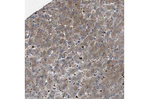 Immunohistochemical staining (Formalin-fixed paraffin-embedded sections) of human liver shows moderate cytoplasmic positivity in hepatocytes. (PPID antibody  (AA 133-207))