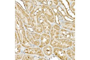 Immunohistochemistry of paraffin-embedded rat ovary using DNA Ligase III/LIG3 Rabbit pAb (ABIN6130288, ABIN6143207, ABIN6143208 and ABIN6217532) at dilution of 1:50 (40x lens). (LIG3 antibody  (AA 730-1009))