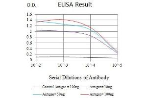 Black line: Control Antigen (100 ng),Purple line: Antigen (10 ng), Blue line: Antigen (50 ng), Red line:Antigen (100 ng) (KRT20 antibody  (AA 1-150))