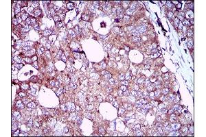 Immunohistochemistry (IHC) image for anti-Epidermal Growth Factor Receptor (EGFR) (AA 693-893) antibody (ABIN1724890)