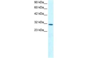 Western Blotting (WB) image for anti-Kruppel-Like Factor 8 (KLF8) antibody (ABIN2460245)