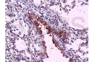 Formalin-fixed and paraffin embedded mouse lung tissue labeled with Anti-MyD88 Polyclonal Antibody, Unconjugated (ABIN736881) at 1:200, followed by conjugation to the secondary antibody and DAB staining (MYD88 antibody  (AA 201-296))