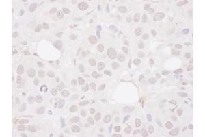 Immunohistochemistry (IHC) image for anti-Symplekin (SYMPK) (AA 200-250) antibody (ABIN7454405)