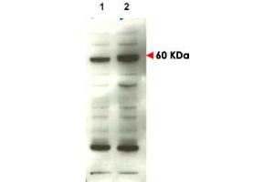 Western blot using SMAD4 polyclonal antibody  to detect over-expressed SMAD4 in transfected COS cells (lane 2).