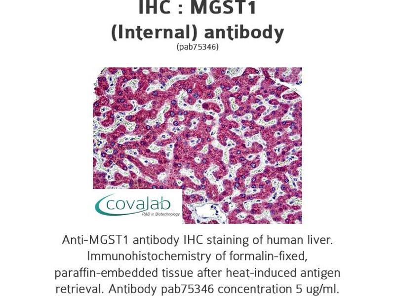 antiMGST1 antibody (Internal Region) Product No. ABIN1736935