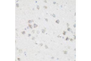 Immunohistochemistry of paraffin-embedded mouse brain using NFU1 antibody at dilution of 1:200 (40x lens). (NFU1 antibody)