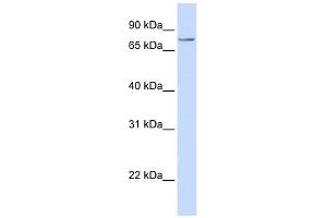SYDE1 antibody used at 1 ug/ml to detect target protein. (SYDE1 antibody)