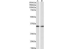 ABIN570988 (0. (PPP4C antibody  (C-Term))