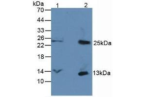 Western blot analysis of (1) Rat Serum Tissue, and (2) Rat Spleen Tissue, using Rabbit Anti-Human bTG Antibody (3 µg/ml) and HRP-conjugated Rabbit Anti-Mouse antibody ( (beta-Thromboglobulin antibody  (AA 59-128))