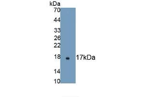 Detection of Recombinant aHSP, Human using Monoclonal Antibody to Alpha-Hemoglobin Stabilizing Protein (aHSP) (aHSP antibody  (AA 1-102))