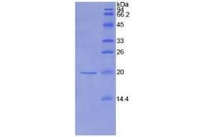 SDS-PAGE analysis of Mouse NME1 Protein. (NME1 Protein)