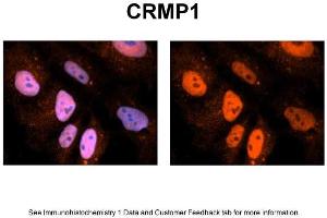 Sample Type: NT2 cells Red: Antibody Blue: DAPI Primary Dilution: 1ug/50ul antibody Secondary Antibody: Alexa goat anti-rabbit 594 Image Submitted by: Yuzhi Chen, University of Arkansas for Medical Sciences (CRMP1 antibody  (N-Term))