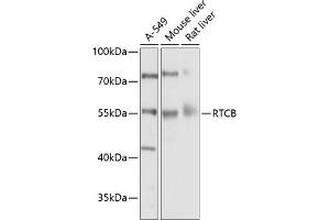 Western blot analysis of extracts of various cell lines, using RTCB Antibody (ABIN6127939, ABIN6147287, ABIN6147288 and ABIN6214508) at 1:1000 dilution. (C22orf28 antibody  (AA 236-505))