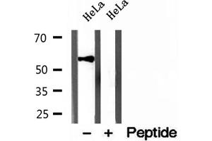 Western blot analysis of extracts of HeLa cells, using KMO antibody. (KMO antibody  (Internal Region))