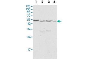 Western blot analysis of CALR monoclonal antibody, clone 1G6A7  against HeLa (1), A-549 (2), NTERA2 (3) and MCF-7 (4) cell lysate. (Calreticulin antibody)