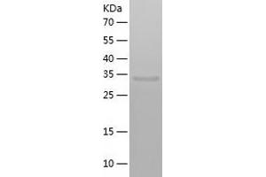 Western Blotting (WB) image for Ornithine Carbamoyltransferase (OTC) (AA 33-354) protein (His tag) (ABIN7285309) (OTC Protein (AA 33-354) (His tag))