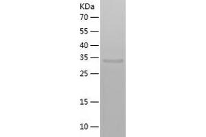 Western Blotting (WB) image for Ornithine Carbamoyltransferase (OTC) (AA 33-354) protein (His tag) (ABIN7124272) (OTC Protein (AA 33-354) (His tag))