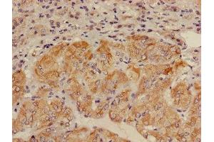 Immunohistochemistry of paraffin-embedded human adrenal gland tissue using ABIN7143672 at dilution of 1:100 (ALDH3B2 antibody  (AA 57-311))