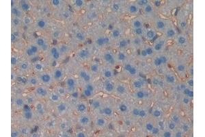 Detection of MUSK in Mouse Liver Tissue using Polyclonal Antibody to Muscle, Skeletal, Receptor Tyrosine Kinase (MUSK) (MUSK antibody  (AA 517-777))